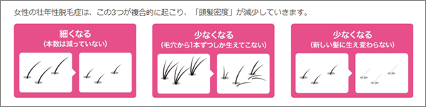 リアップリジェンヌ